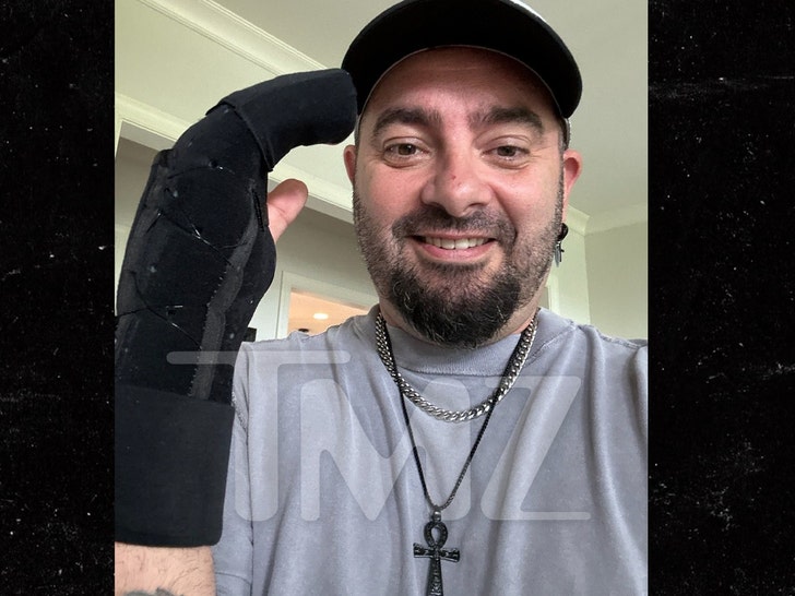 chris kirkpatrick's broken hand