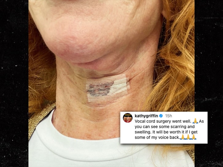 be275acdf5ea43e2b0e0e85708501d18_md kathy griffin vocal cord