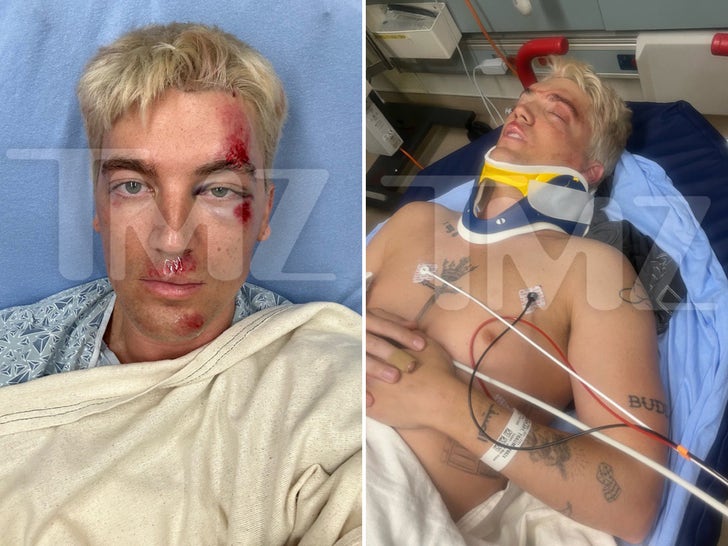 Paul Klein's Gruesome Injuries