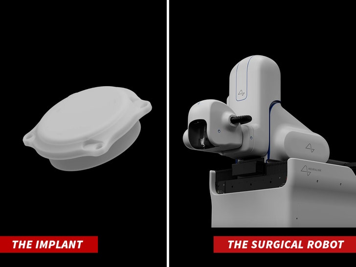 neuralink the implant the surgical robot 1
