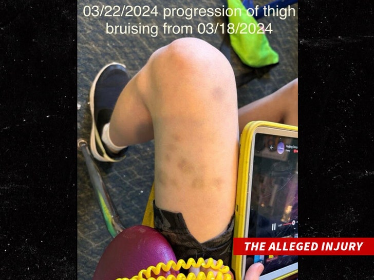 2dfec35837384ffe9cdd07ab1eaa7c55_md-1 disabled child injuries