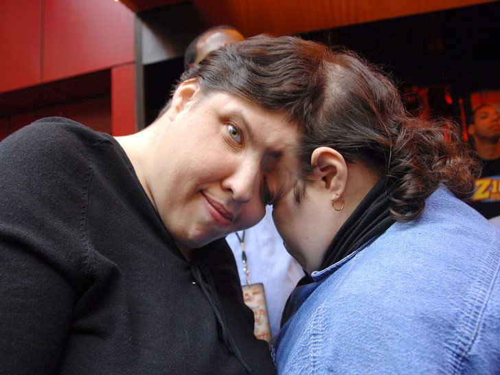 Siameses Lori y George Schappell