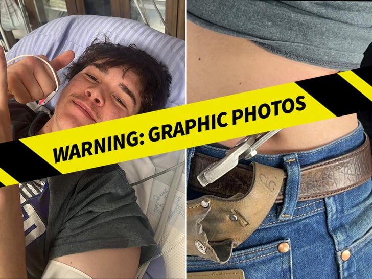 Kansas Teen Impaled By Pliers In Freak Accident -- The Graphic Injuries