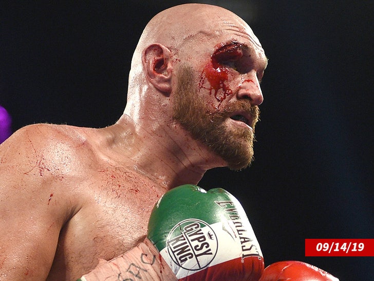 806dac2dc1d44f7c898948bb57c3dfed_md tyson fury cut above eye sub