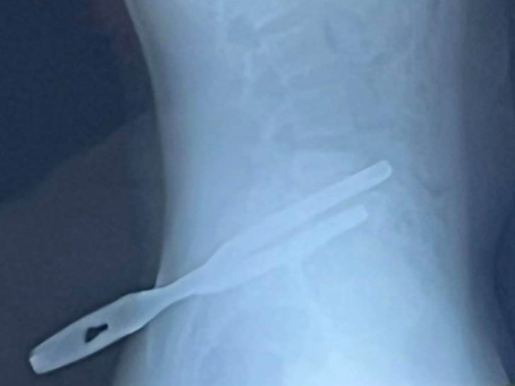 0125-Teen-Impaled-Ice-Accident-SUB-2