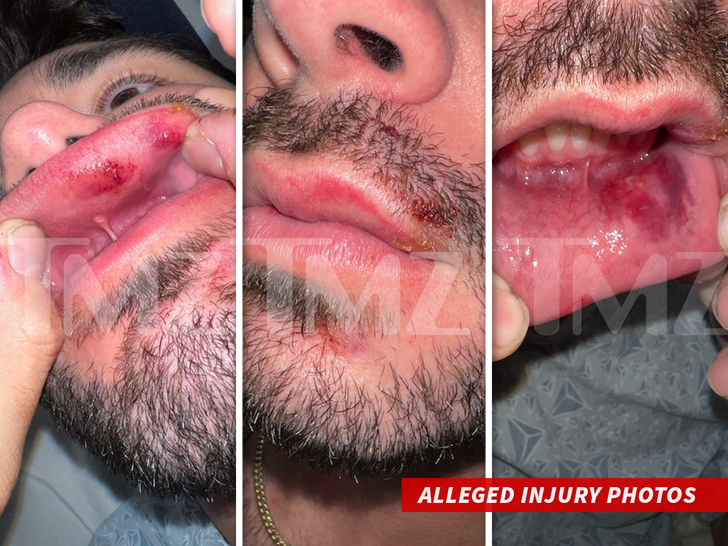 958d3665fc864c198b7473b098cb6c4f_md Jack Doherty 2 -- Sued for Assault and Battery For Bodygaurd