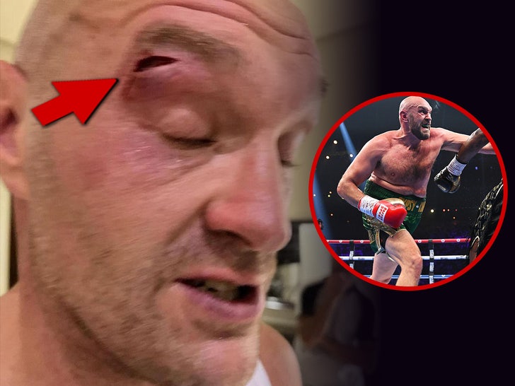 d43b8a27cf2b41f7a5b884db2c1b88aa_md tyson fury cut above eye with arrow main