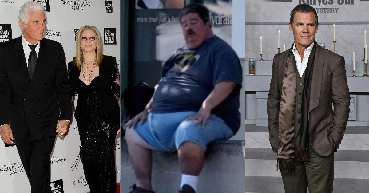 hollywood icons beg save bloated blotch covered son
