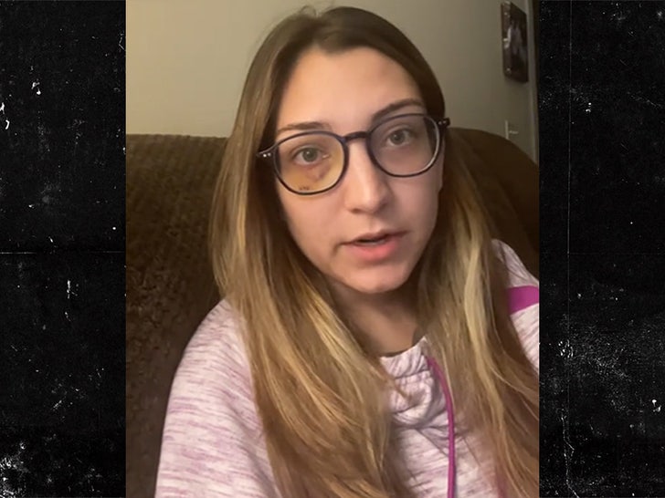 062423-subway-sucker-punch-black-eye-primary