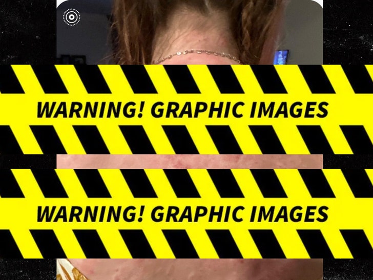 09c4cb62262747d6a863c8b9ffcc0b86_md Injuries Sustained From Hail at Red Rocks Park and Amphitheatre