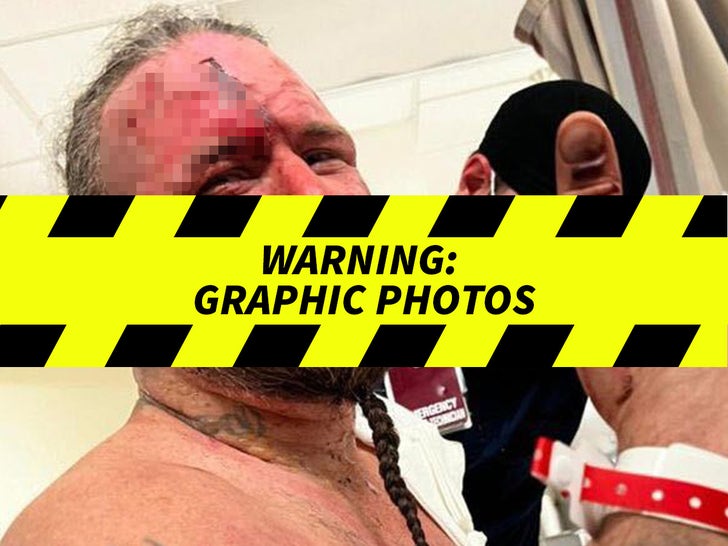 MASADA Graphic Injuries