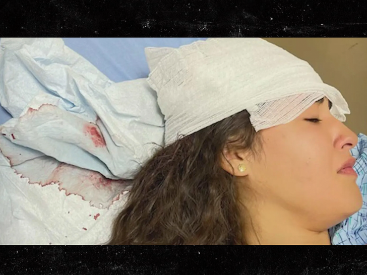 girl injured in police attack