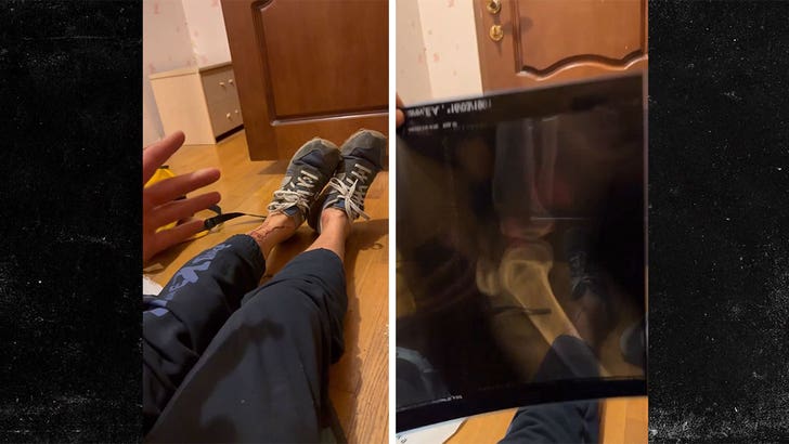 083023-car-stunt-injury-kal