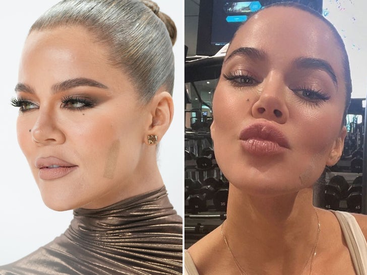 Khloe Kardashian On The Mend
