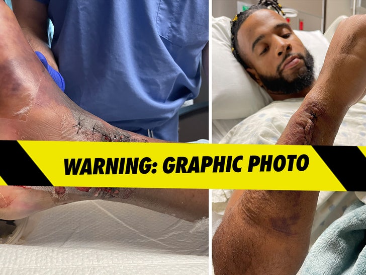 Nelson Thomas Injuries