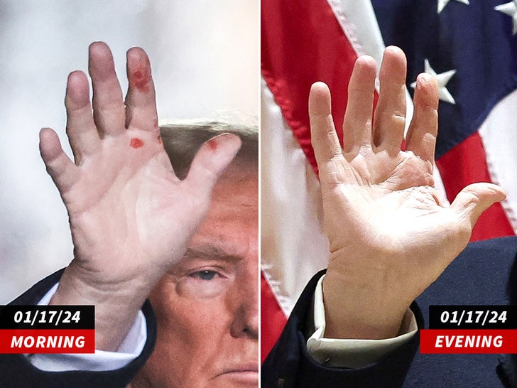 9c14217474294046ab1c4a8bbcca2663_md trump hand split