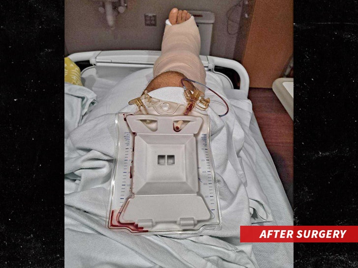 man infection after surgery 1