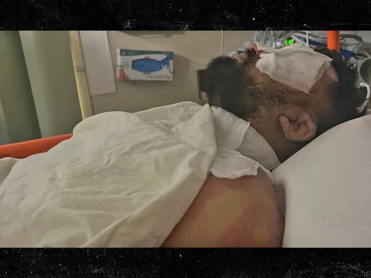 Gofundme suraj burnt by shoplifter 2