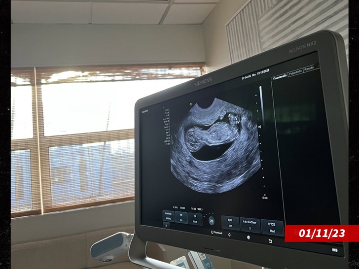 bf370e564a7843278a1813a8f10826a9_md naomi osaka