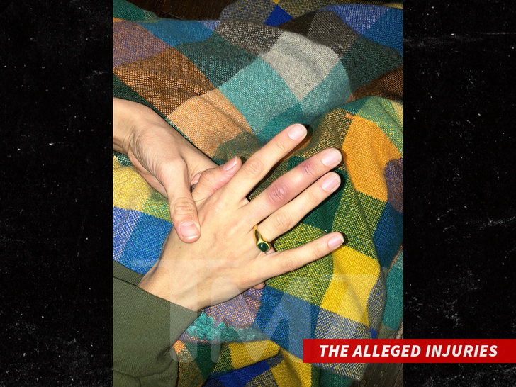 Grace Jabbari alleged injuries new