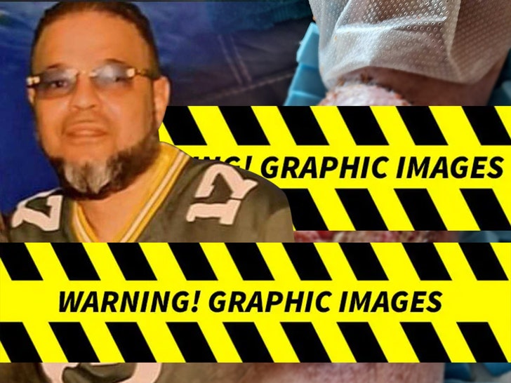 Man Claims Surgery Left Him With Disgusting Wound -- Graphic Photo